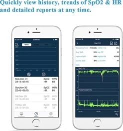 Best Getest Oxysmart Vinger Saturatiemeter - Smart Zuurstofmeter - Pulse Oximeter Met Hartslagmeter - Medisch Apparaat - Bluetooth (Zwart) 17 Best Getest Oxysmart Vinger Saturatiemeter - Smart Zuurstofmeter - Pulse Oximeter Met Hartslagmeter - Medisch Apparaat - Bluetooth (Zwart) -Winkel Voor Thuisgezondheidsmeetapparatuur 1133x1200 1