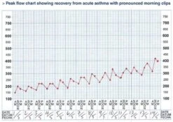 Micropeak Peak Flow Meter 18 Micropeak Peak Flow Meter -Winkel Voor Thuisgezondheidsmeetapparatuur 1200x850
