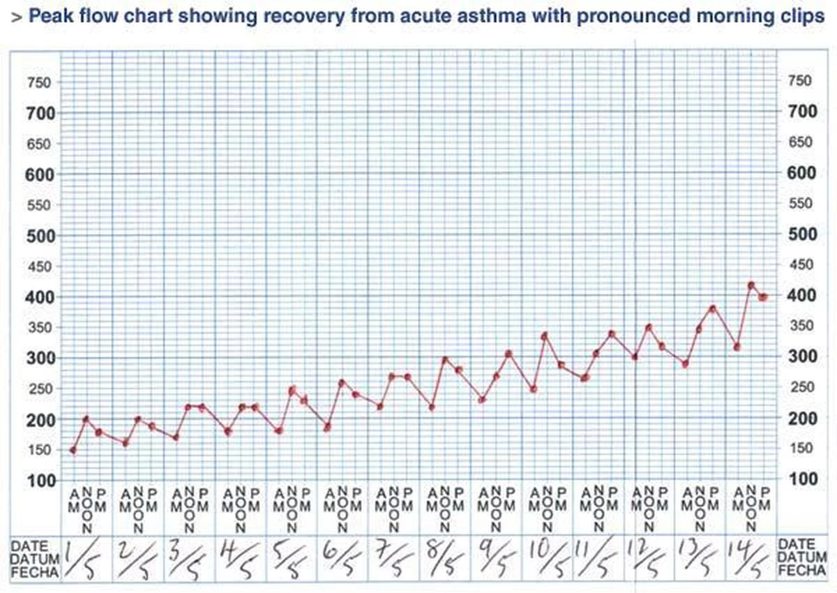 Micropeak Peak Flow Meter 9 Micropeak Peak Flow Meter - Afbeelding 7